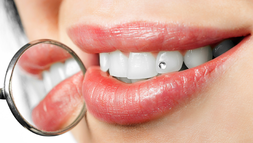 Eternally Lit Smiles | Teeth Whitening