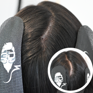 Scalp Micropigmentation Orlando