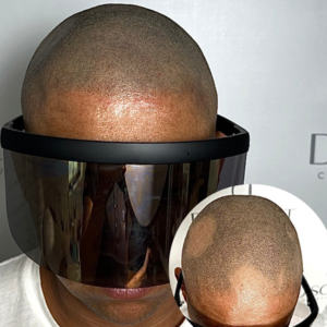 Scalp Micropigmentation Near Me