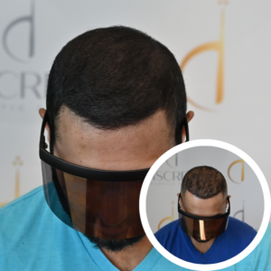 Scalp Micropigmentation SMP Orlando | Discreet Cosmetic Studios