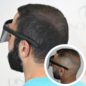 Scalp Micropigmentation SMP Orlando | Discreet Cosmetic Studios